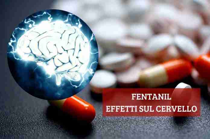 Fentanil